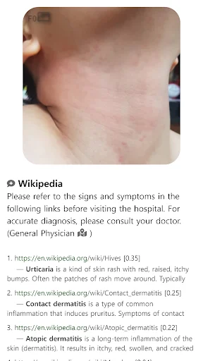 Baixar Model Dermatol – Atlas de Doenças de Pele Grátis - Screenshot 12