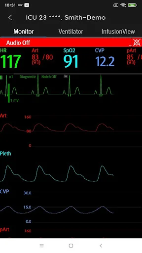 Download Mindray Mobile Viewer: Monitoramento Médico Remoto - Screenshot 3