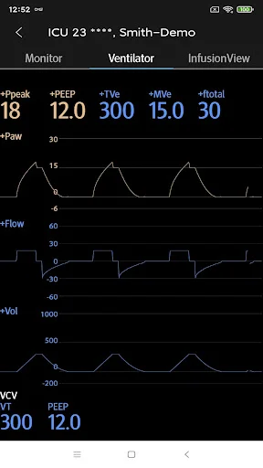Download Mindray Mobile Viewer: Monitoramento Médico Remoto - Screenshot 4