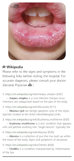 Baixar Model Dermatol – Atlas de Doenças de Pele Grátis - Screenshot 8