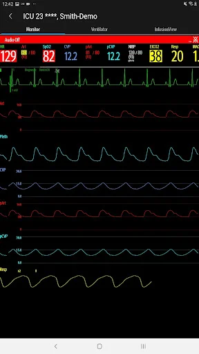 Download Mindray Mobile Viewer: Monitoramento Médico Remoto - Screenshot 11